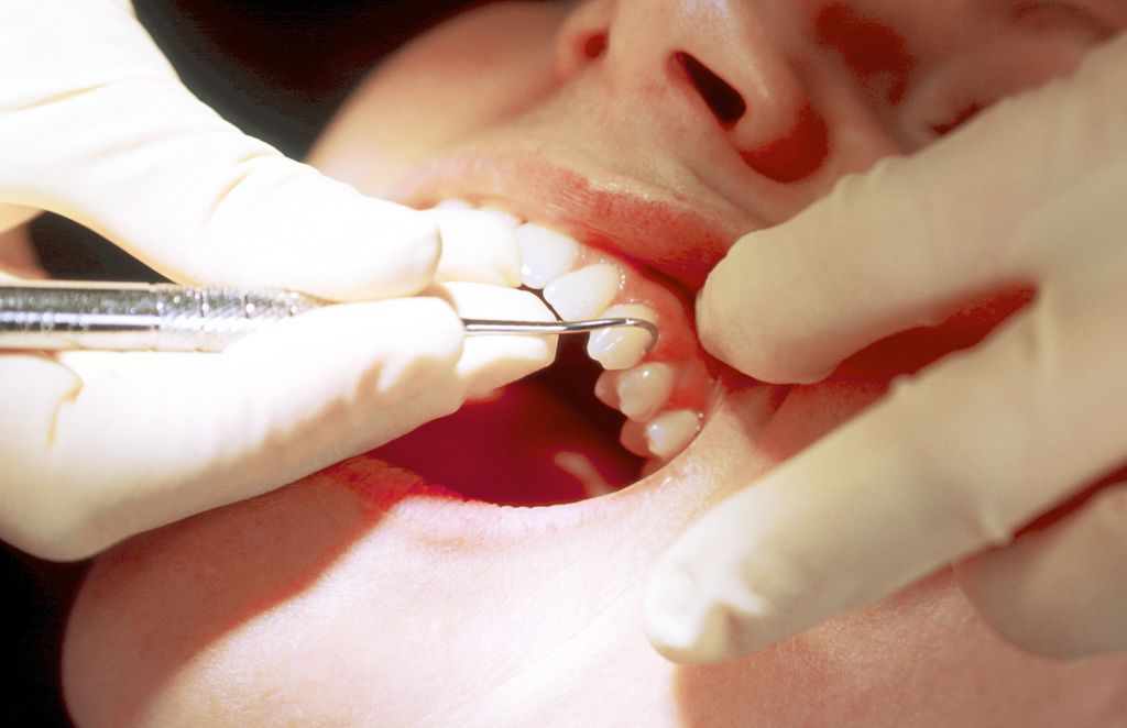 歯周病と全身疾患との関係性
